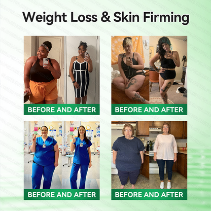 𝑶𝒇𝒇𝒊𝒄𝒊𝒂𝒍 𝑺𝒕𝒐𝒓𝒆  | 👩‍⚕️𝑴𝒐𝒓𝒊𝒏𝒈𝗮 · 𝗕𝗲𝗿𝗯𝗲𝗿𝙞𝙣𝙚 × 𝙉𝘼𝐃+ 𝟏𝟎-𝐢𝐧-𝟏 𝗔𝗱𝘃𝗮𝗻𝗰𝙚𝙙 𝙉𝙖𝙣𝙤 𝙈𝙞𝙘𝙧𝙤𝙣𝙚𝙚𝐝𝐥𝐞 𝐏𝐚𝐭𝙘𝙝(𝐉𝐮𝐬𝐭 𝐨𝐧𝐜𝐞 𝐚 𝐝𝐚𝐲, 𝐯𝐢𝐬𝐢𝐛𝐥𝐞 𝐜𝐡𝐚𝐧𝐠𝐞𝐬 𝐢𝐧 𝟕 𝐝𝐚𝐲𝐬） ✅ 𝐅𝐨𝐫 𝐨𝐛𝐞𝐬𝐢𝐭𝐲, 🅛🅞🅞🅢🅔 🅢🅚🅘🅝,𝐝𝐢𝐚𝐛𝐞𝐭𝐞𝐬, 𝐬𝐥𝐞𝐞𝐩 𝐚𝐩𝐧𝐞𝐚, 𝐣𝐨𝐢𝐧𝐭 𝐢𝐬𝐬𝐮𝐞𝐬, 𝐚𝐧𝐝 𝐦𝐨𝐫𝐞