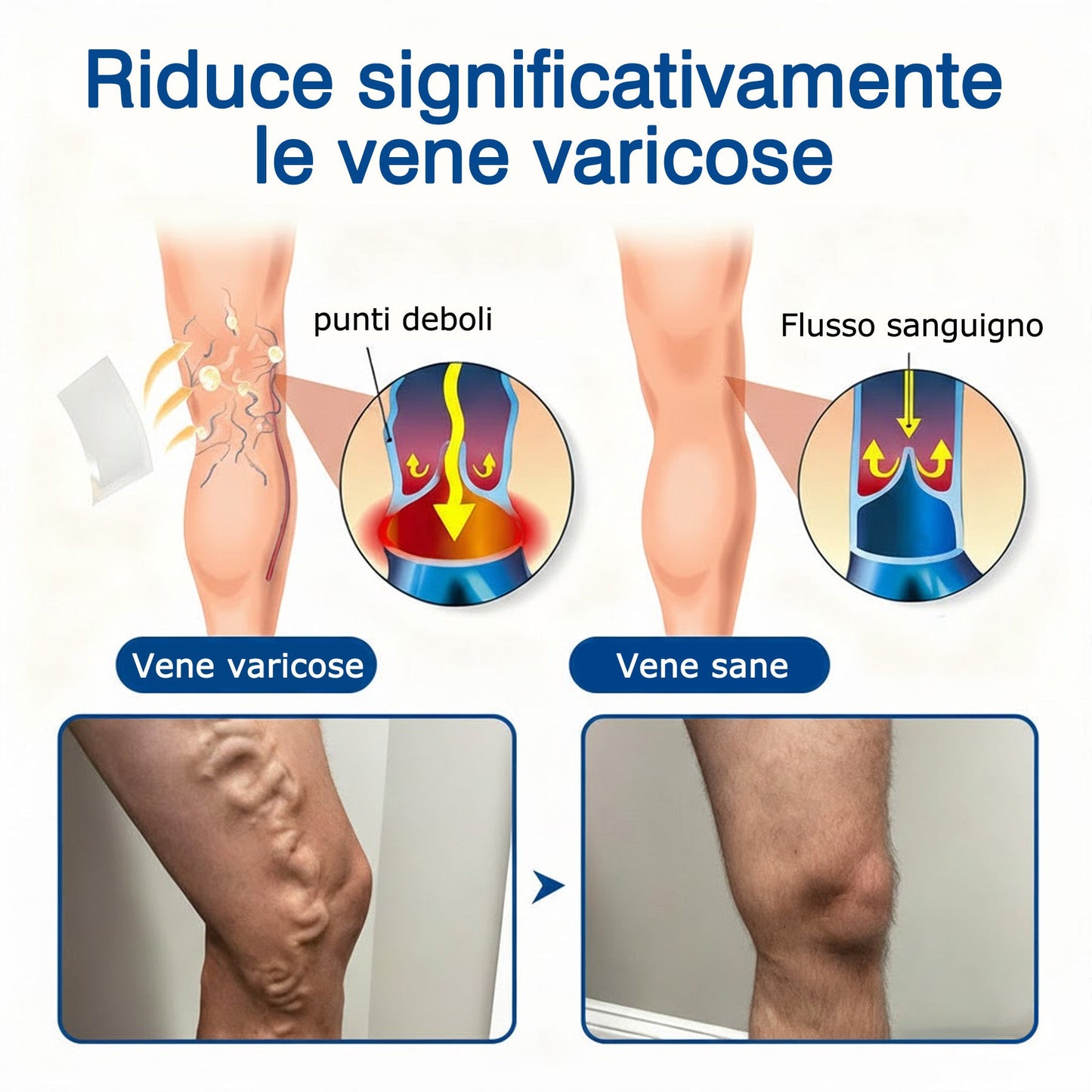 🇮🇹🔥GFOUK® Cerotto con Microaghi Rilassante Venoso⚡Sollievo immediato, risultati a lungo termine