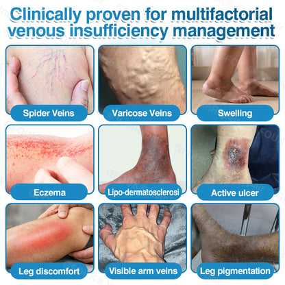 🇺🇸✅️🌱GFOUK® VeinRepair Microneedle Patch Roll⚡Instant Relief, Long-Term Results